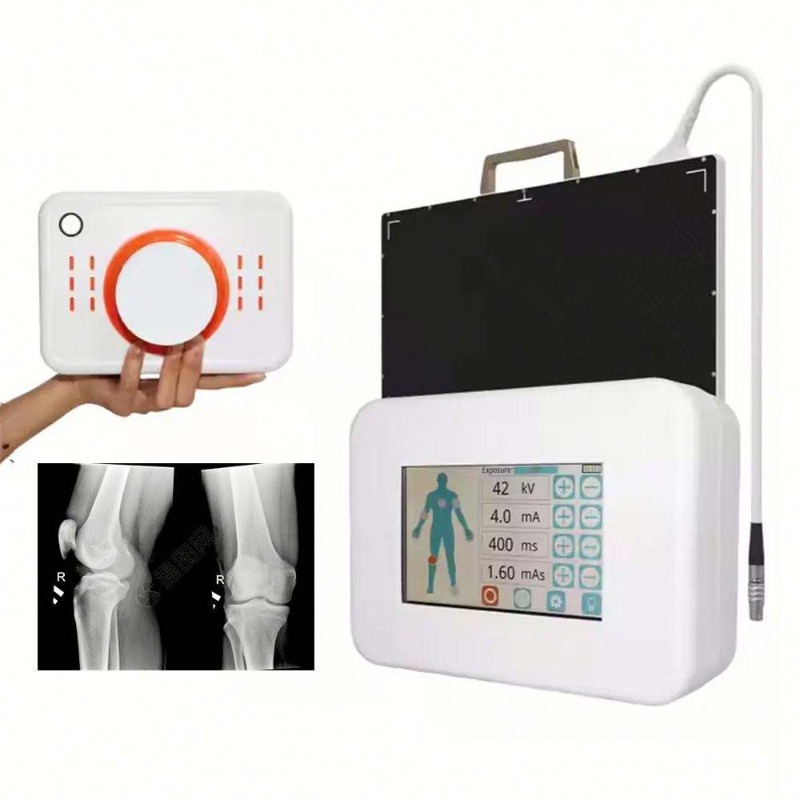 Appareil de radiographie numér - Veterinary X-Ray avis et prix